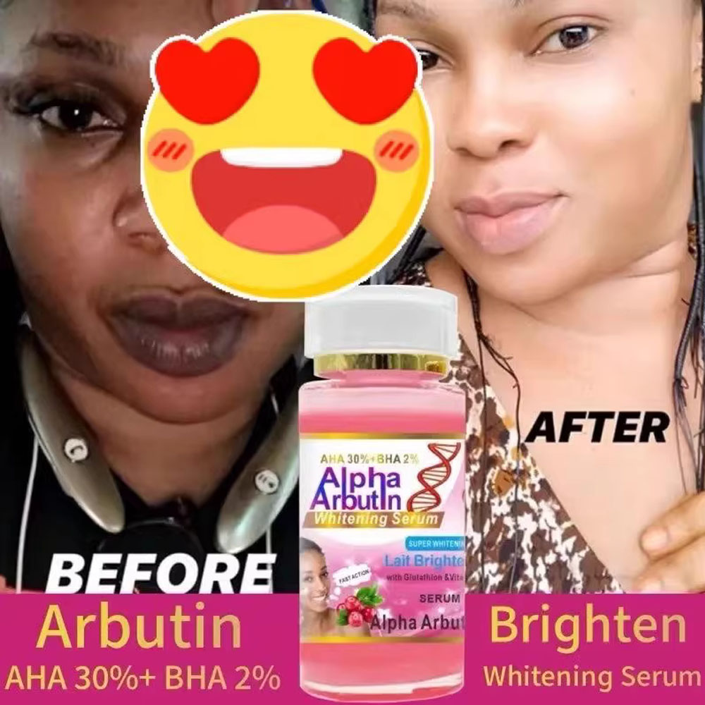 Siero alfa arbutina AHA 30%+ B - Alpha Arbutin Serum recensione e prezzo