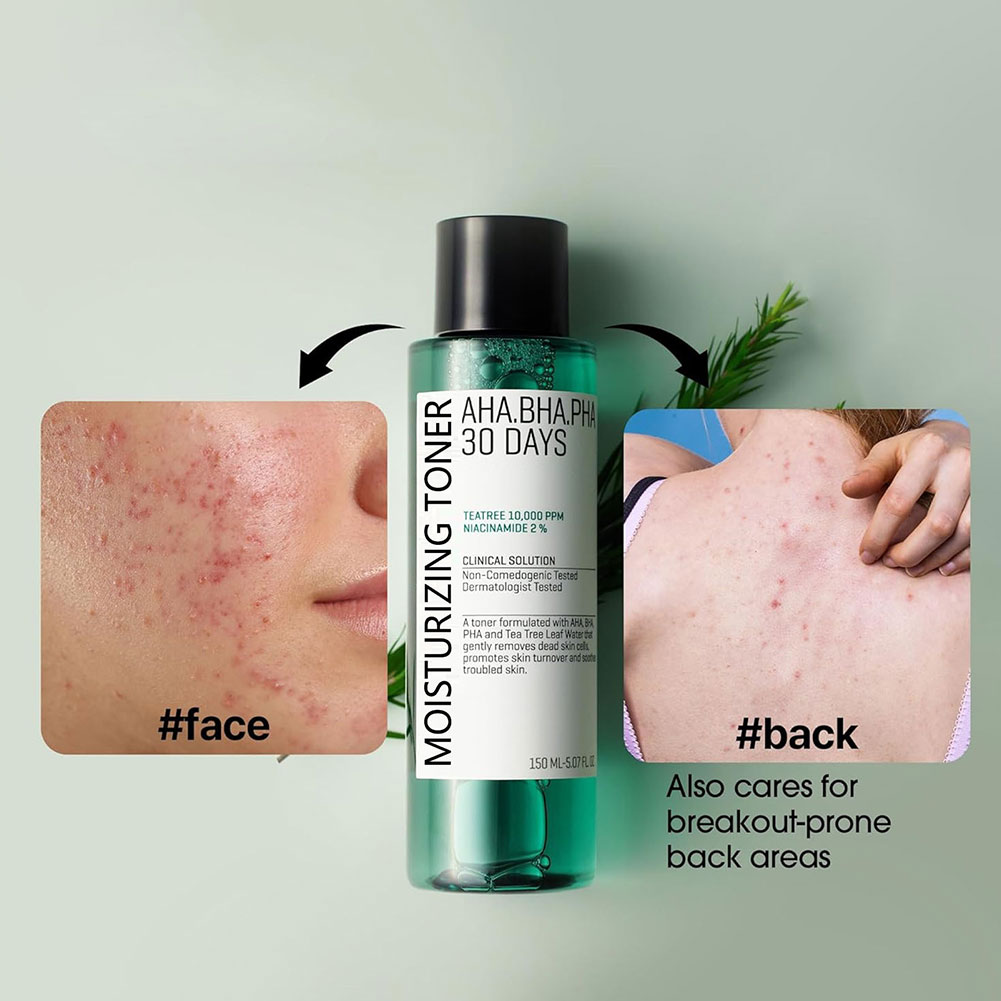 Some by Mi Aha.Bha.Pha 30 Days - Skincare Some By Mi recensione e prezzo