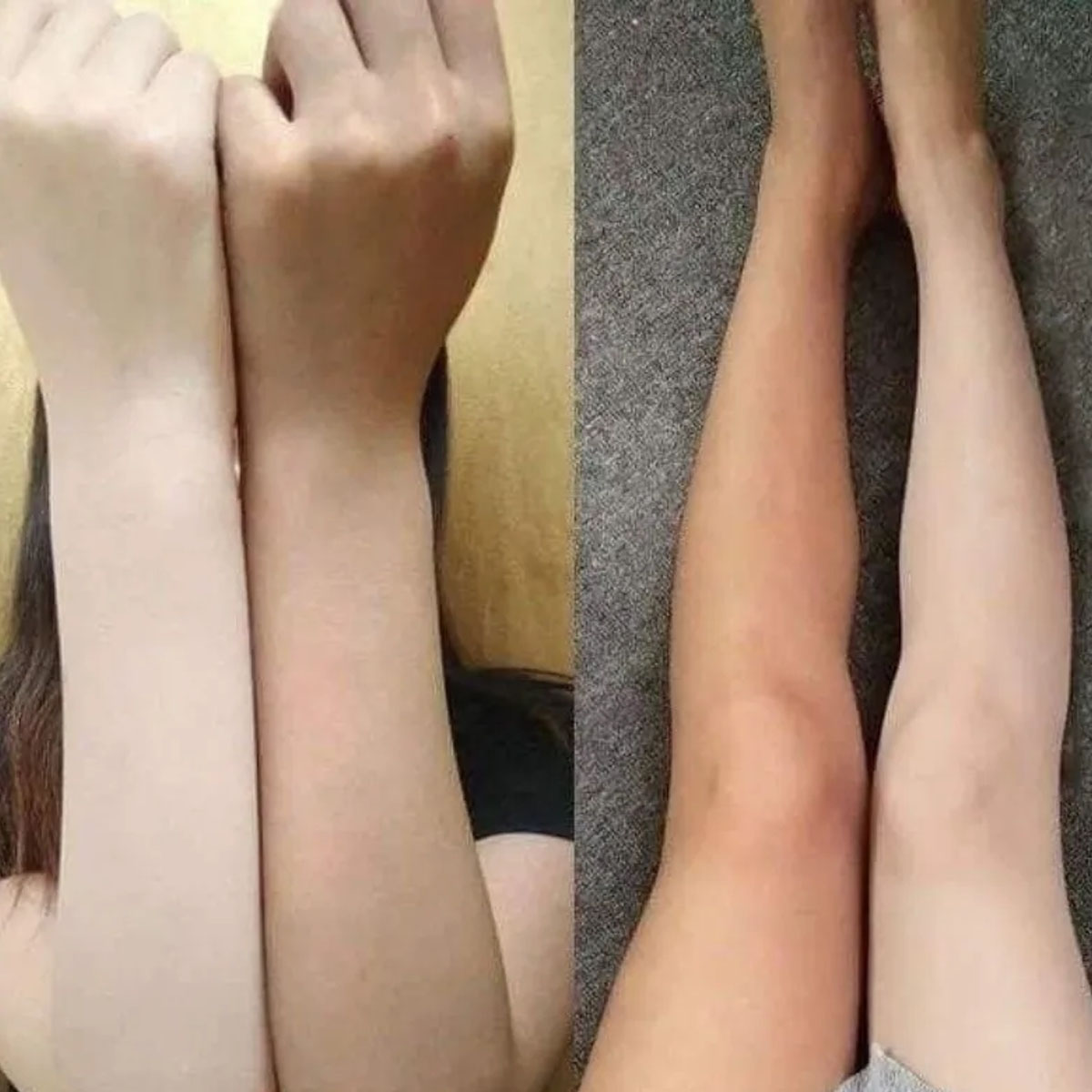 ng Siero kaki trng da Alpha Ar - Alpha Arbutin Serum recensione e prezzo