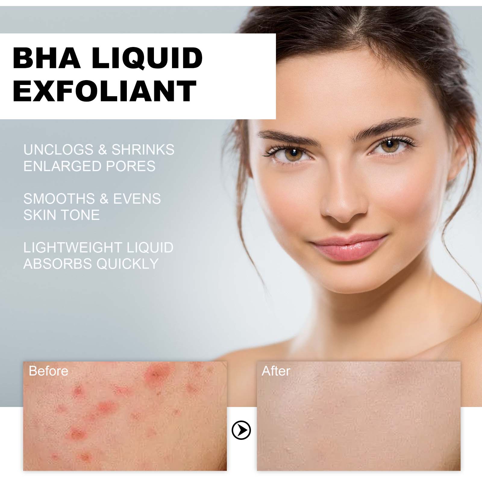 Siero Esfoliante Liquido con 2 - Glycolic Acid Exfoliant recensione e prezzo