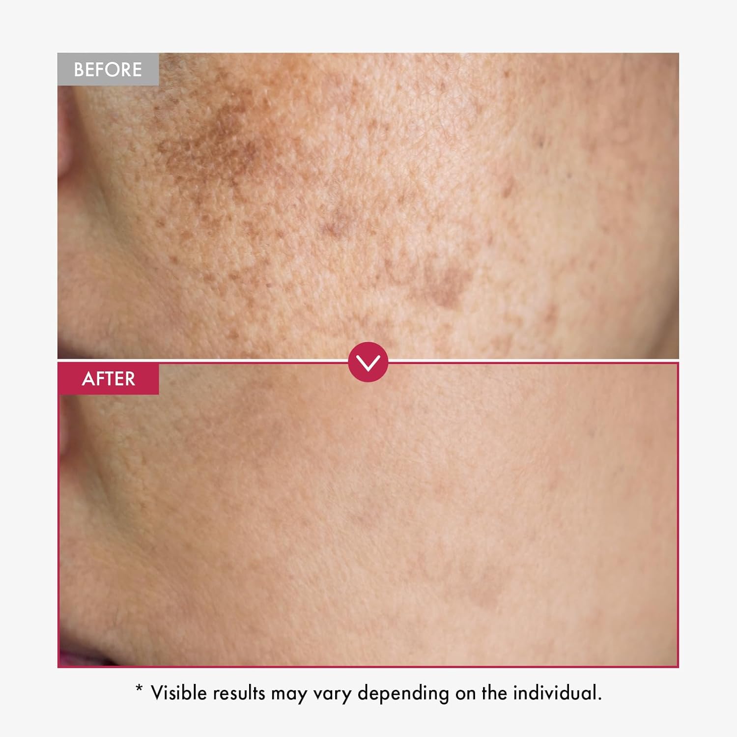 Siero viso sbiancante per la p - Alpha Arbutin Serum recensione e prezzo