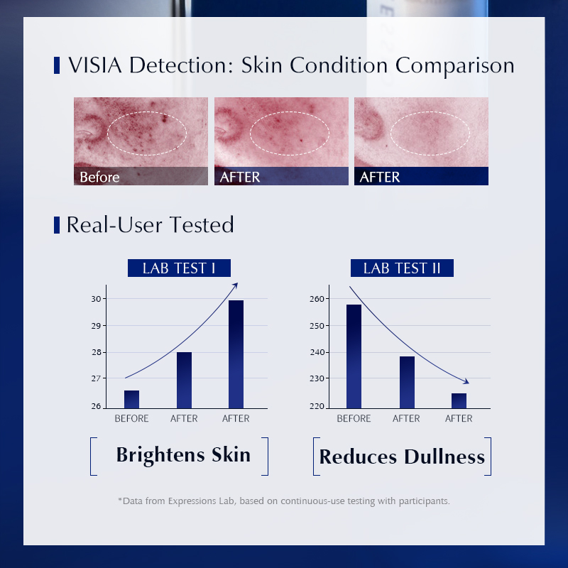 Siero Schiarente per Macchie S - Alpha Arbutin Serum recensione e prezzo